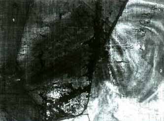 Fotografía de la imagen radiográfica del ángulo inferior derecho de la obra